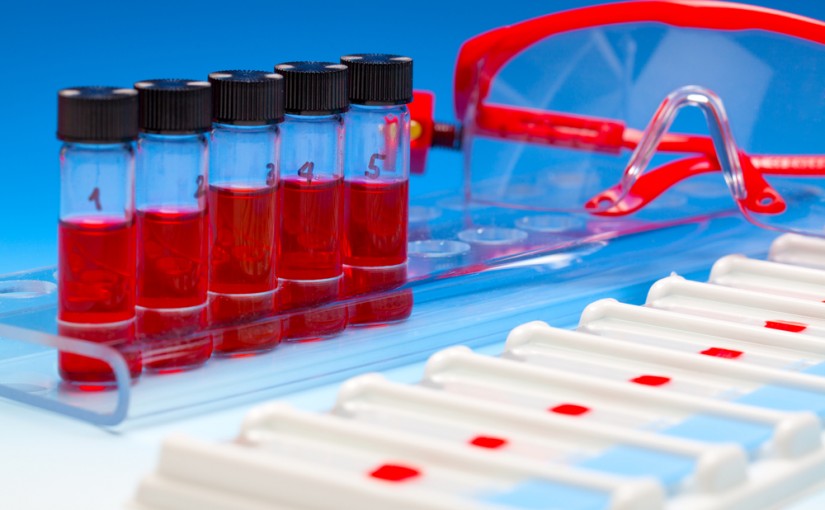 Will Liquid Biopsies Help Ovarian Cancer Survivors?
