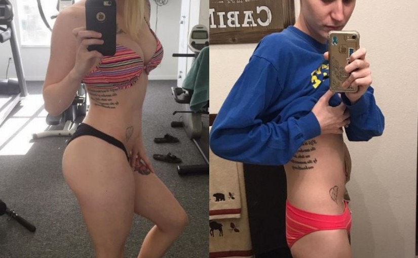 A 23-Year-Old Bodybuilder Is Being Ravaged By Ovarian Cancer — And Instagramming It