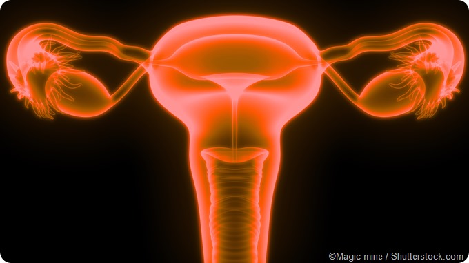Ovarian Cancer and Genetics