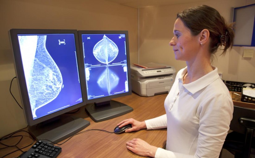Breast and Ovarian Cancers: Large Study Improves Estimates of Genetic Risk