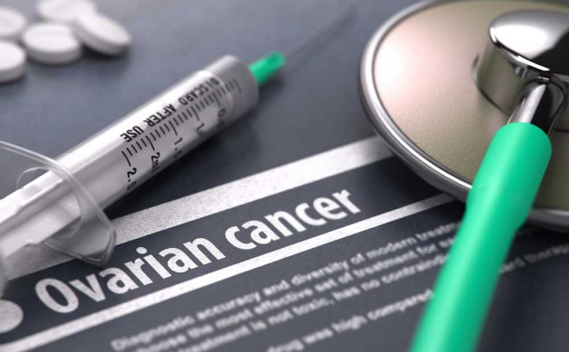 Most Ovarian Cancers Start In The Fallopian Tubes, Study Finds
