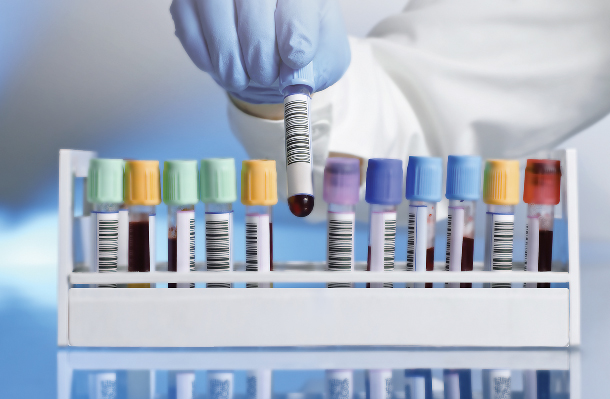 Liquid Biopsy Tests in People with Cancer: An Expert Review