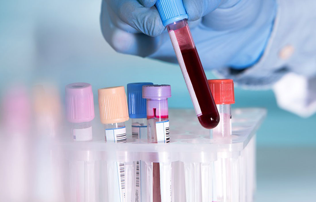 New Blood Test Could Spare Cancer Patients From ...