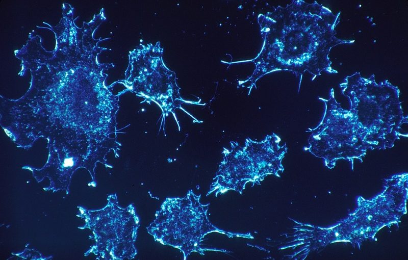 ImmunoGen’s Ovarian Cancer Drug Misses Phase III Primary Endpoint