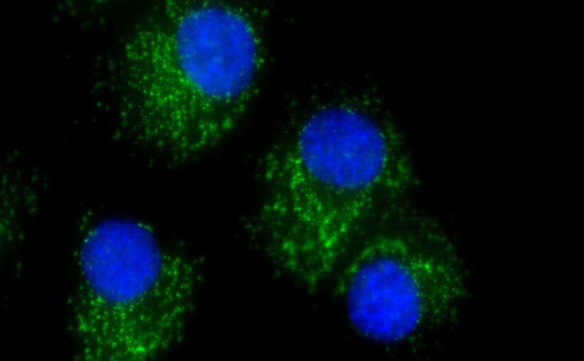 Targeting a Key Protein May Keep Ovarian Cancer Cells from Spreading