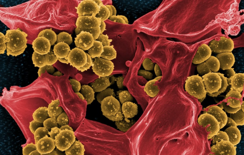 Berzosertib: Protein-Targeting Drug Used to Treat Cancer May Have Same Effect on Coronavirus