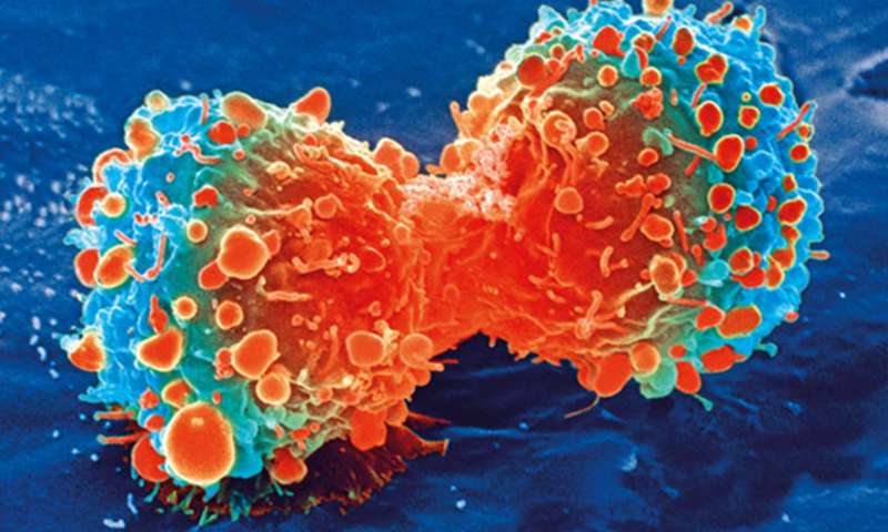 Study: The Immune Effects of Seclidemstat in Aggressive Ovarian Cancer Striking Young Women