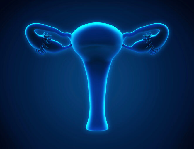 PARP Inhibitors Deemed Too Costly For Across-the-Board Frontline Maintenance in Ovarian Cancer