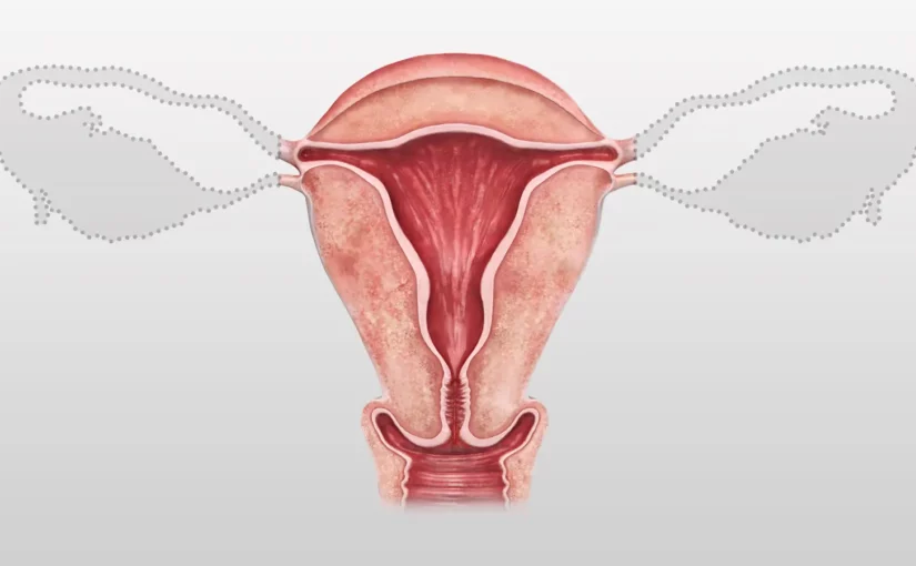 A computer rendering of the female reproductive system with the ovaries replaced by dotted line silhouettes.