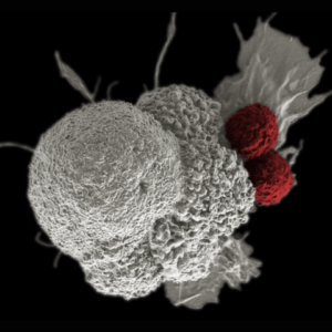 Cytotoxic T cells (red) are shown attacking a squamous cancer cell (white). Image credit: Rita Elena Serda, National Cancer Institute/Duncan Comprehensive Cancer Center at Baylor College of Medicine
