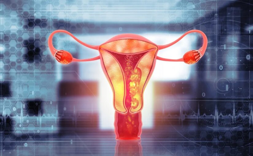 Protein Discovery Aids Ovarian Cancer Detection