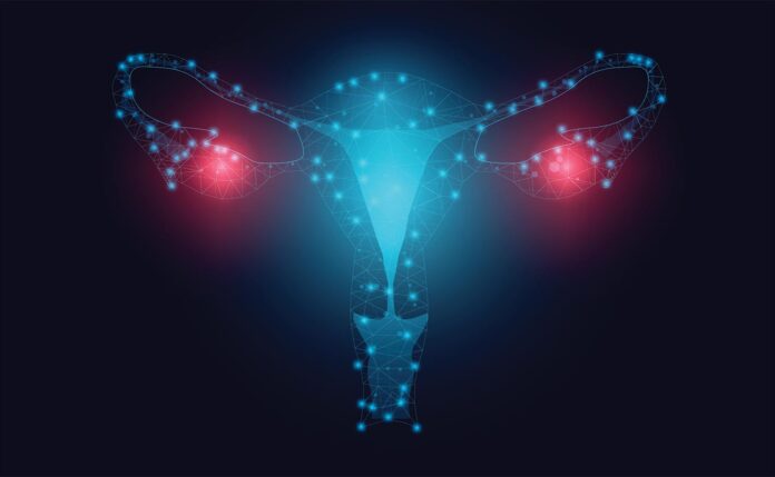 Diagnosing the “Silent Killer”: AI Tackles Early Stage Ovarian Cancer